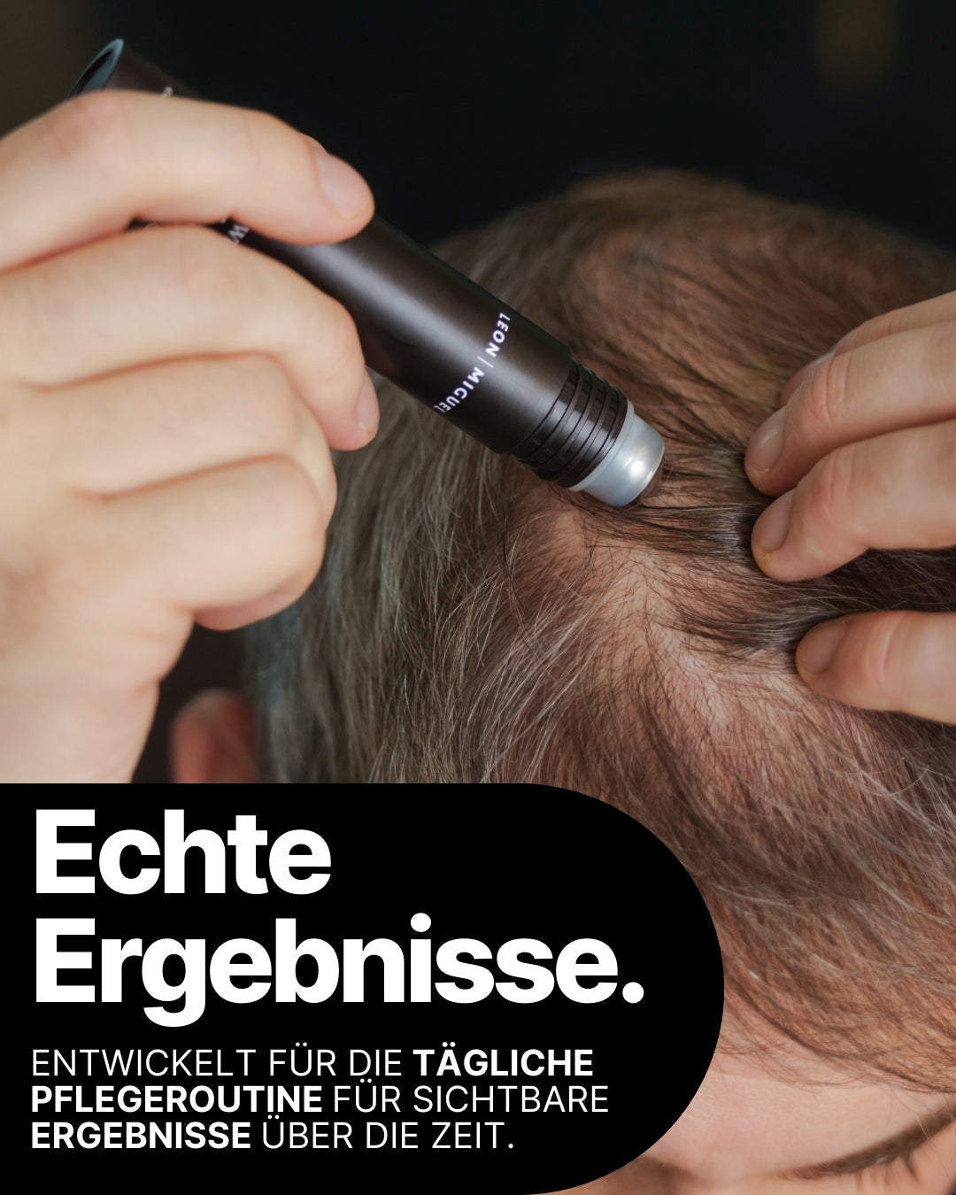 hair growth activator